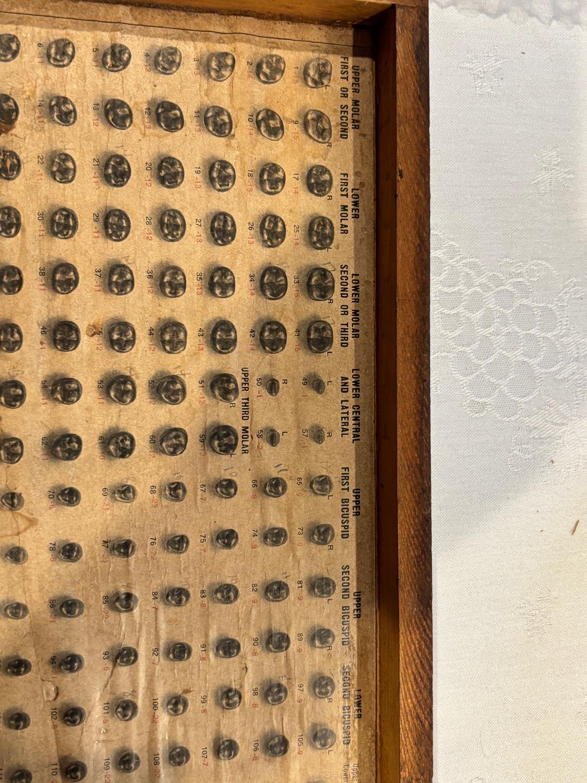 Complete Patented 1910 S.S. White Precision Dental Shell Die & Punch Set